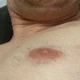 massagetyp